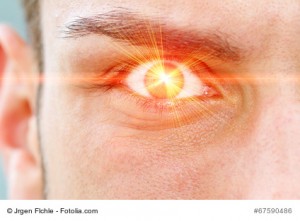 Eye Laser